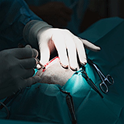 Hernia